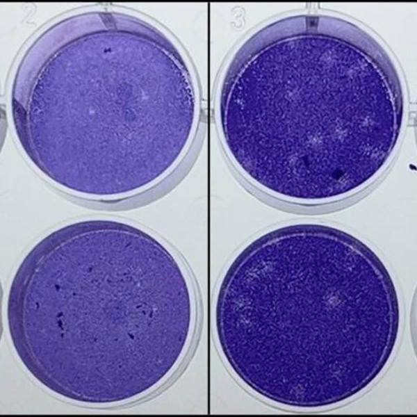 Cells treated with the compound (right) showed reduced infection from the Omicron variant compared to untreated cells (left). Photo credit: Dr. Selvarani Vimalanathan, Molecular Biomedicine